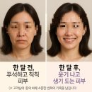 보석힐링다이어트