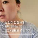 서피부과의원 | 마포피부과 이중턱 없애는 법, 슈링크 인모드 리프팅 리얼 후기