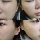 강남피부관리 서울 강남구 청담동 청담에스테틱 살롱드영 위치 가격 후기 추천