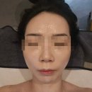 정릉66 | [성북/정릉] 웨딩축소관리 경락맛집 &#39;민스킨앤바디&#39;