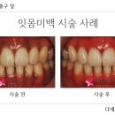 디에르치과의원 이미지