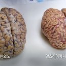 대한민국 치매 보고서 이미지