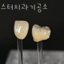 은혜치과기공소 이미지