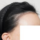 바람부는날에도 성형외과의원 네이버블로그