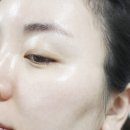 (주)에버셀 | 에버셀차움 앱솔루트 럭스 셀 프로그램 피부줄기세포배양액화장품*