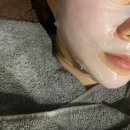 국제연예인종합예술단 | 신사피부과 올타이트리프팅 후기 처진 얼굴 개선 후기