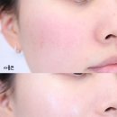 ㈜바른환경 | 지 1등 수분 크림, NEW 레드 블레미쉬 클리어 수딩 크림 EX로 더 강력해지다?! 민감성피부 꼼꼼 비교 후기