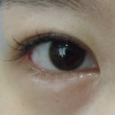 쌍꺼풀앞머리 모양 변화 : 쌍꺼풀 높이로 조절하기