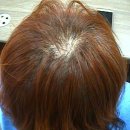 노틸러스 PC 춘천석사점 | 춘천두피탈모 엠지에프-생활속 잘못된 습관이 탈모를 유발해요