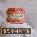 열린수치과의원 네이버블로그