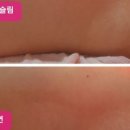 케이인케이