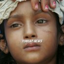 OPD MEDICAL 이미지