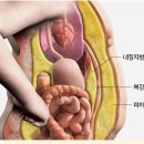 본앤장한의원 네이버블로그