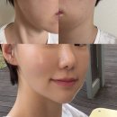 크라이오365 | 알엑스퍼트 포스트케어 3종 후기｜피부과 레이저 시술 후 피부염 진정 루틴