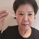 모아뷰티인셀덤 | [모아뷰티 인셀덤] 래디언솜™100 실사용 후기 🕊