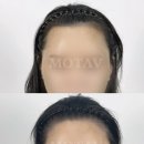 헤어;권하다 네이버블로그