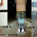 브리스건강기능성속옷 이미지