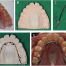 STL치과기공소 이미지
