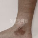 장기반점 네이버블로그