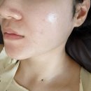 미미썸의원 부산 덕천점 | [공지] 내돈내산💰 슈링크+윤곽주사+사각턱보톡스 (통증, 후기, 효과, 정보, 재생크림)