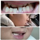 아이사랑치과의원 | 인천부평 아이사랑치과의원