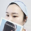 ㈜시원 | 여자정수리탈모 초기 관리, 다노날 두피 트리트먼트 쿨링팩 후기