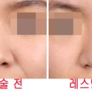 예뻐지는시간 이미지