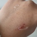 대웅약국 | 대웅제약 egf 새살연고 사용 후기 판매 약국