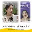 천호역피부과 텐써마리프팅 300샷 비용 및 리얼후기