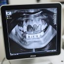 웰메이드덴탈 | 갑자기 뻐근함 실화? 내 치아 걱정 타임 왔음