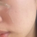 속건조 해결 아누아 PDRN 히알루론산 세럼 후기