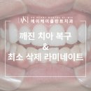 이영진치과의원 네이버블로그