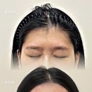 헤라헤어라인 | 부천 헤어라인 왁싱 후기 ㅣ 얼굴형까지 달라 보이는 이유