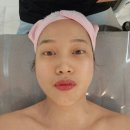 피부아지트(뉴페이스) 이미지