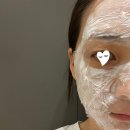 대전 스킨보톡스 내돈내산 피부과 3곳 후기