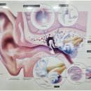 오티콘보청기 분당점 이미지