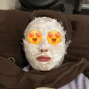 수앤은의원 | 💉잠실 피부과 수앤은의원 리쥬란힐러+수분주사(히알루론산) 후기 -1회차