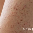 지오마 | ​[내돈내산 바디스크럽 추천] 지오마 일루미네이팅 레몬라임 솔직 후기 🍋(모공각화증 효과 대박..!)