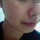 카티스트 | *세모마스크팩* 메디카티스트 삼각팩 사용후기 :^)