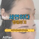 세연온마음의원 | 천안 자연눈썹 잘하는 곳, 예쁜 눈썹의 완성! 세연하다 방문후기