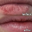 애프터팜 윤약국 | 에스로반 연고 상처 가격 약국 효능 (+입술 상처에 사용 가능)