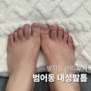엔케어센터 | 대구 내성발톱 발각질 관리하러 엔케어센터 간 후기