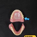 스마일기공소 네이버블로그