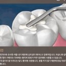 서울큰치과의원 네이버블로그