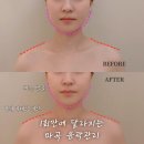 채움메디칼 | 마곡 에스테틱 추천, 비대칭 윤곽관리 효과 좋은 채움미에스테틱