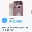 [흉터치료]연세스타피부과 브이빔레이저_1회차