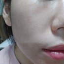 피부장벽케어 식이유황 MSM 추천템 큐라에스 엠에스비타 솔직후기