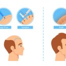 careful hair