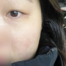 뷰티플렉스피부관리실