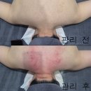 한울컴퓨터 - 서귀포시 일주동로 8539 | 전주에스테틱 추천 전주피부관리 한울에스테틱 드레스라인 관리로 완성하는 목선 쇄골라인 변화